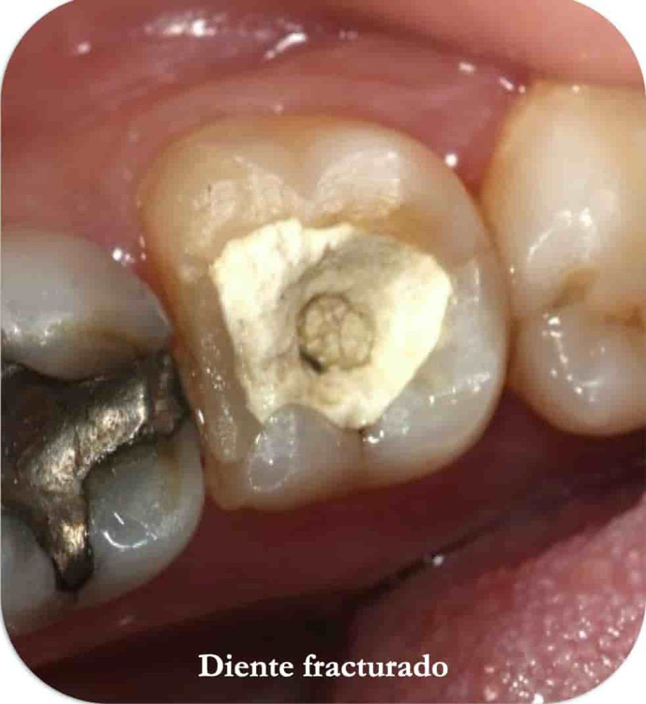 endodoncias