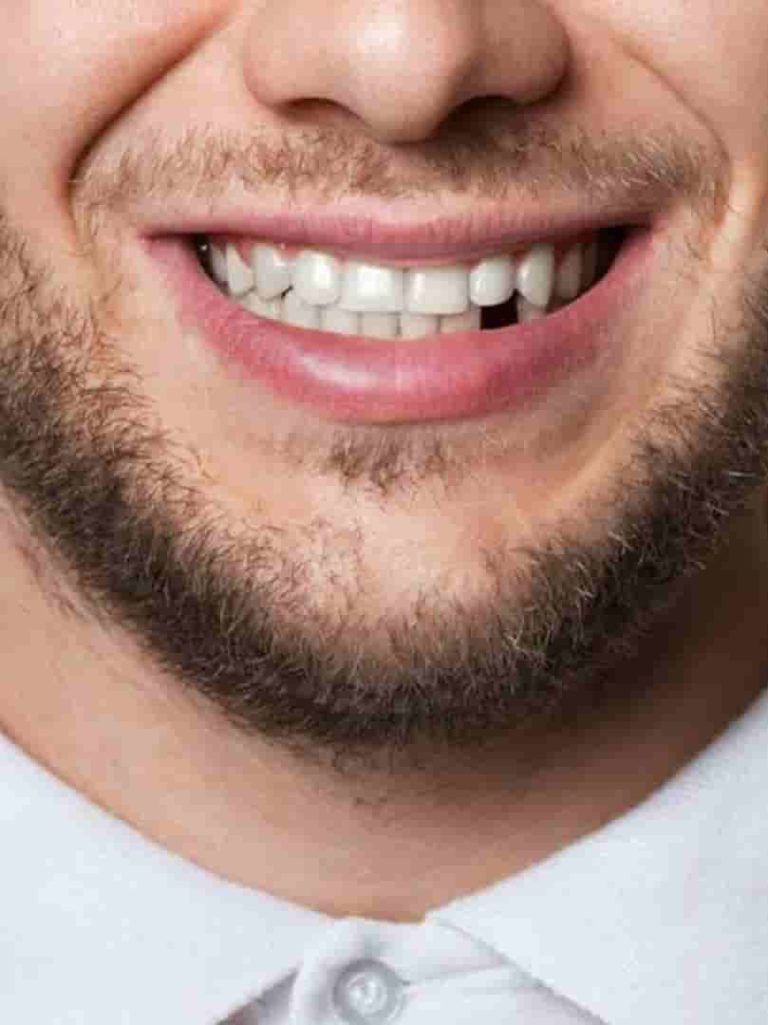 dientes ausentes madrid
