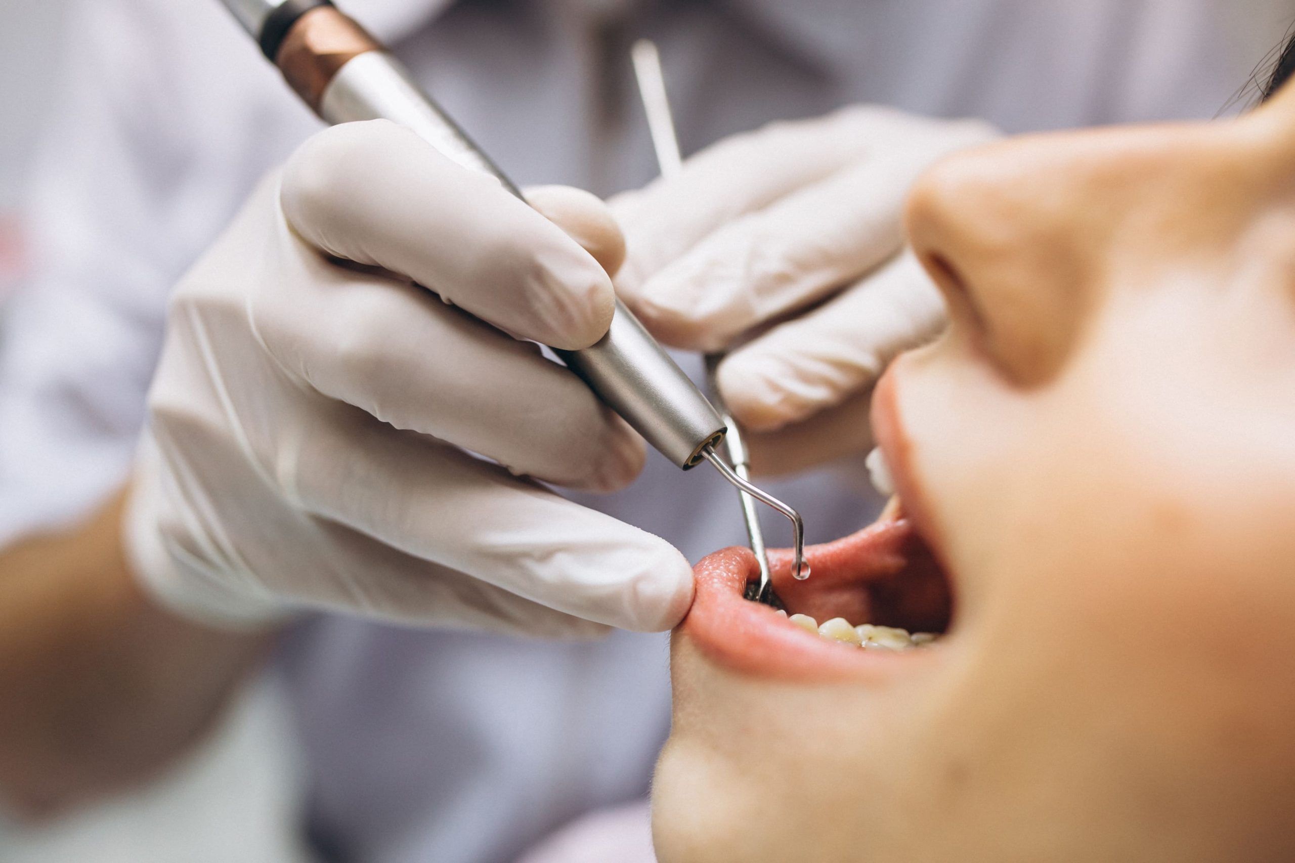 La importancia de las revisiones dentales periódicas