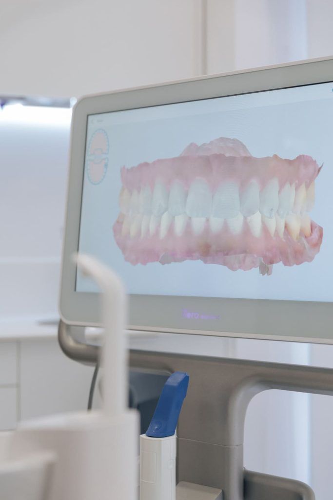 diseño de sonrisa chamberí