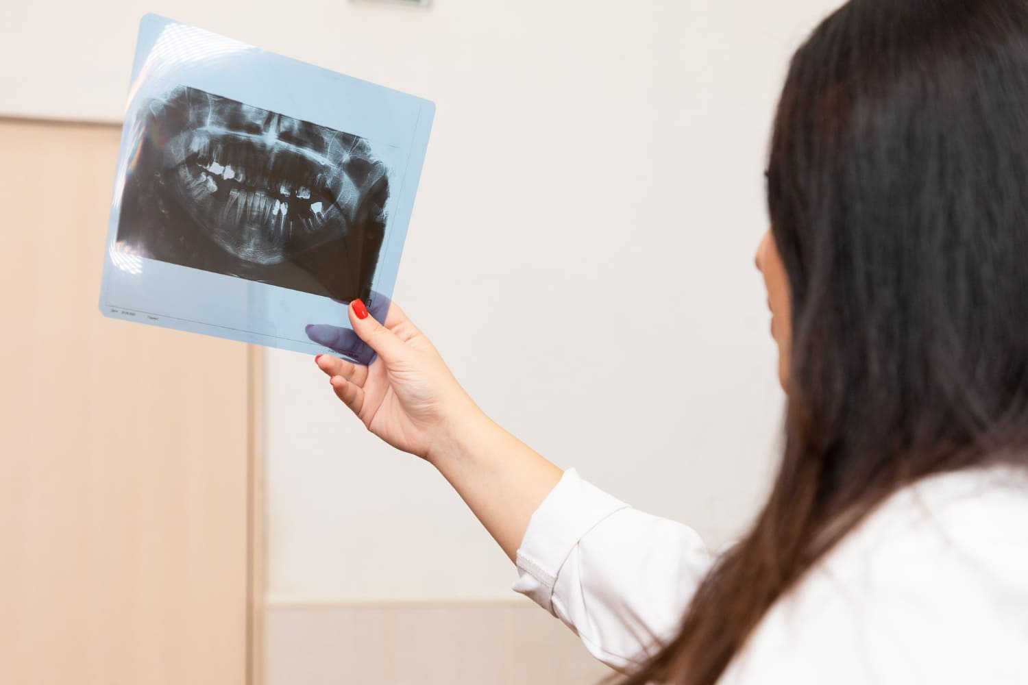 cuándo no se puede regenerar hueso dental