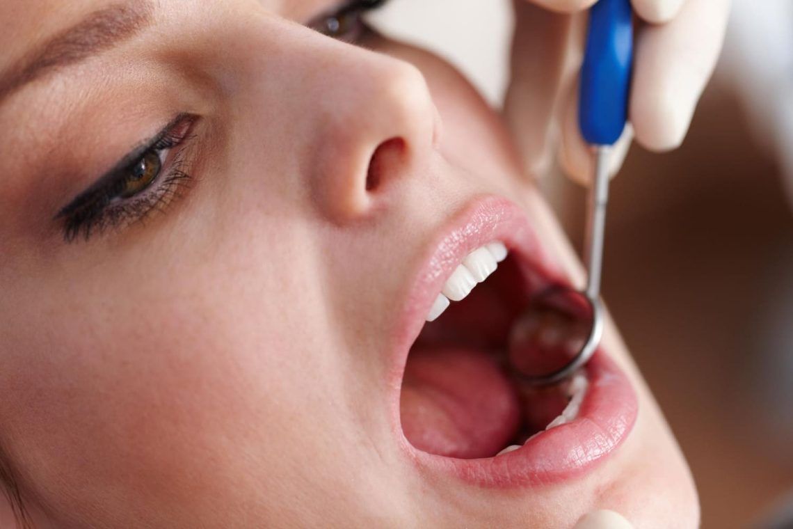 cómo se hace un empaste dental