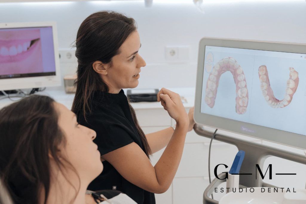 Decidiendo entre puentes dentales o implantes dentales de acuerdo a la necesidad del paciente