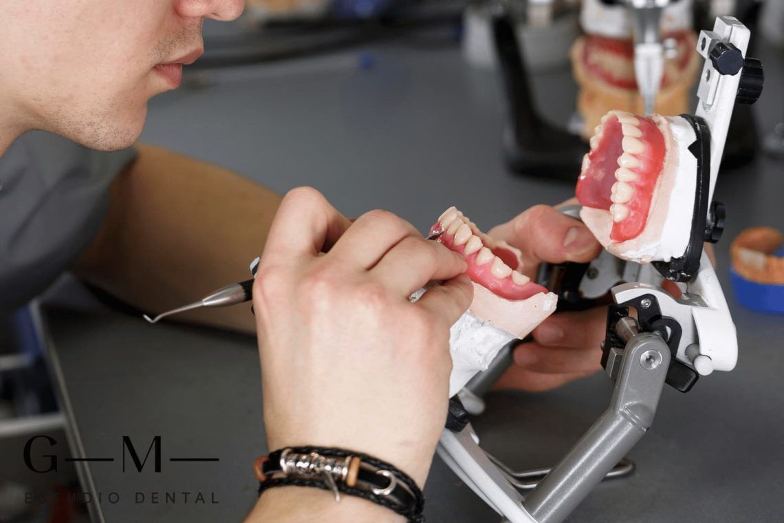 Tipos de prótesis dentales